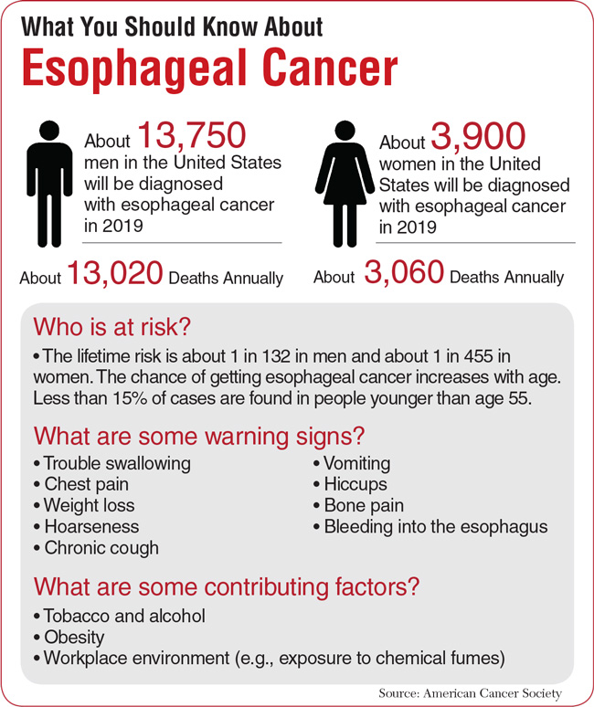 Esophageal cancer graphic