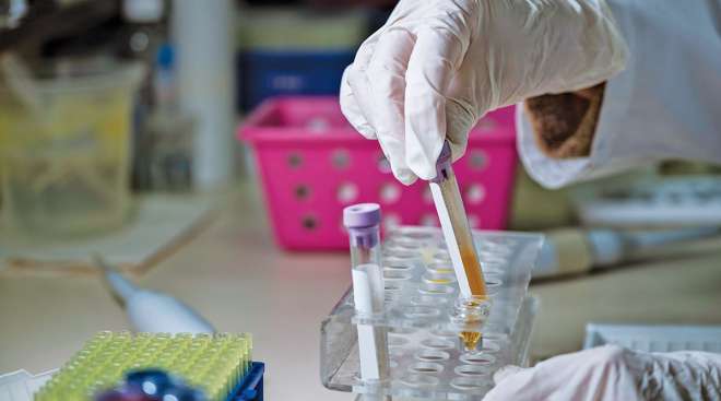 Getty image of a drug test sample